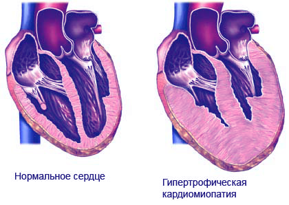 ������� ��������������